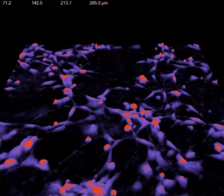 Science meets ancient knowledge in cancer care – The Jerusalem Post