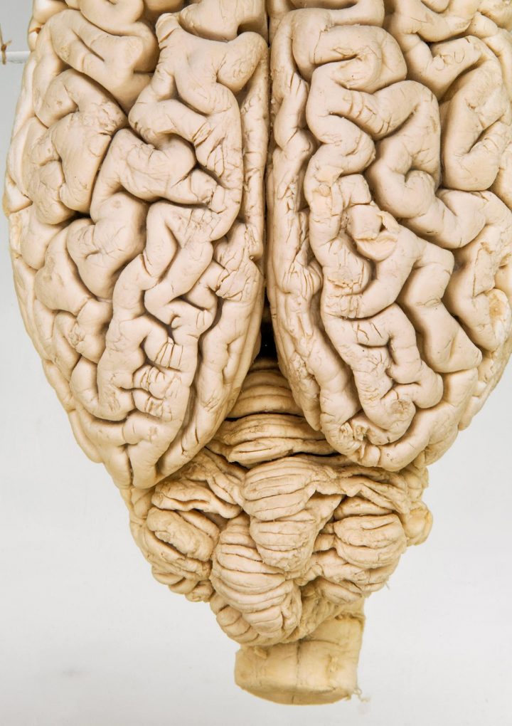 Pig brains partially revived hours after death—what it means for people – National Geographic