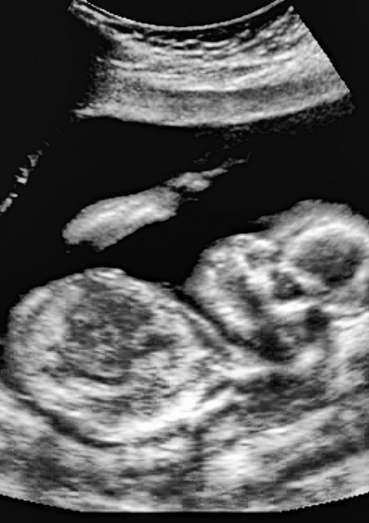Is Fetal Tissue Research Vital To Medicine? Here’s What The Experts Say – The Daily Caller