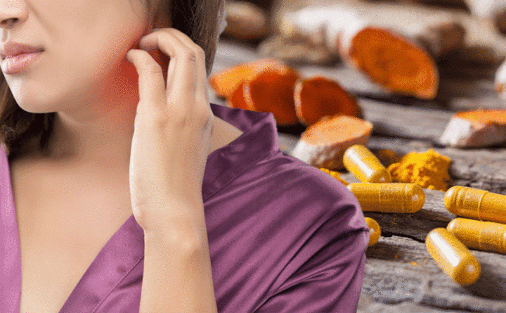 Eczema supplements: Best supplements to soothe symptoms associated with the skin condition – Express