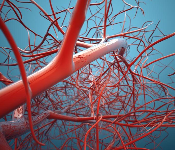 Higher iron levels may protect arteries but raise clot risk – Medical News Today