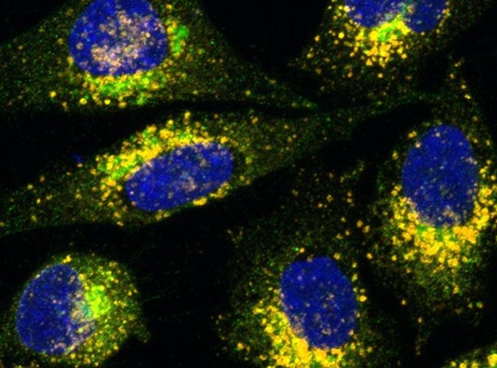 Could a grape-based compound improve gene therapy efficiency? – FierceBiotech