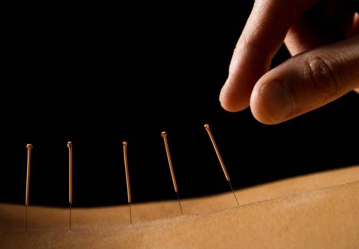 My Turn: Consumer Reports is off-base on Natural Medicine – Concord Monitor