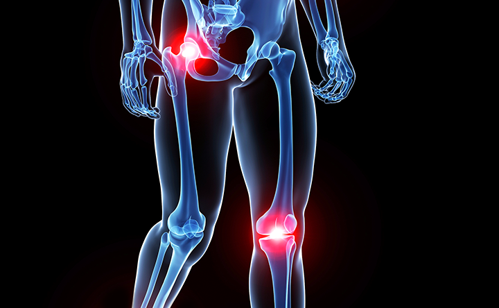 NIH grant funds Brittle Bone Disorder Consortium – Baylor College of Medicine News