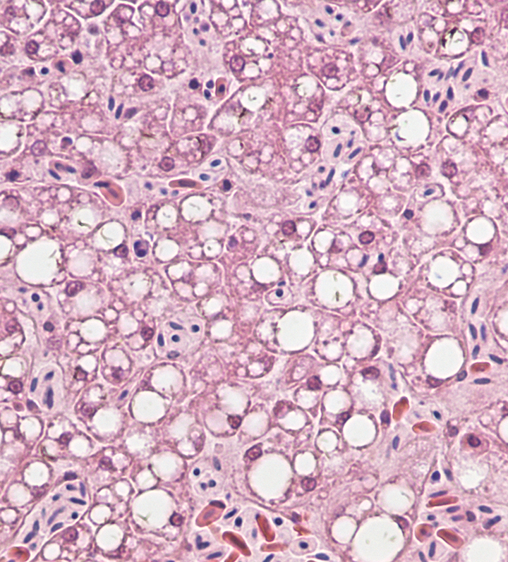 UW Study: Newly Discovered Virus Infecting Nearly A Third Of Bald Eagles – Wisconsin Public Radio News