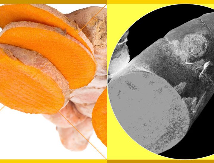 What Are the Benefits of Turmeric? – The New York Times