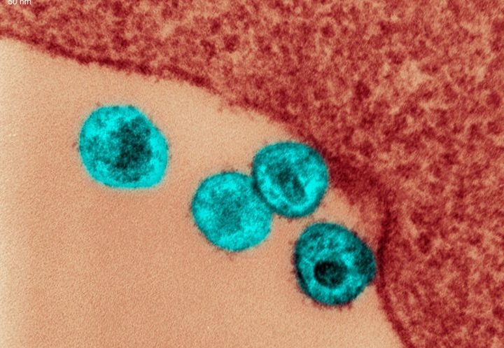 HIV-Positive Babies Fare Better When Treatment Starts at Birth – Scientific American