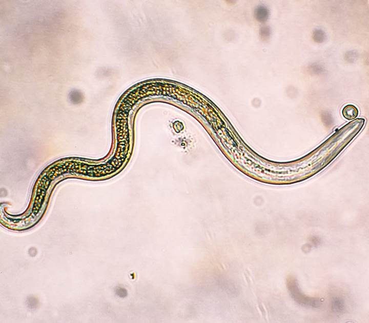 On Facebook, fears of parasites push people to post pictures of feces and pursue dangerous remedies – NBCNews.com