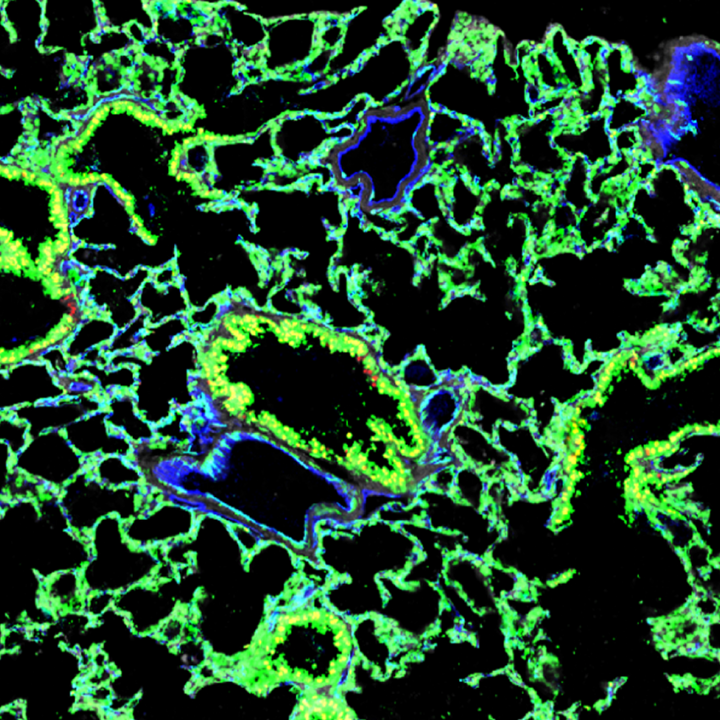 Stem Cell Transplants Used to Grow Fully Functional Lungs in Mice – Columbia University Irving Medical Center