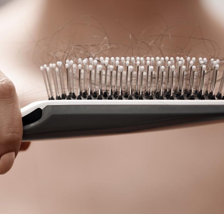 10 ways of treating female hair loss – Medical News Today