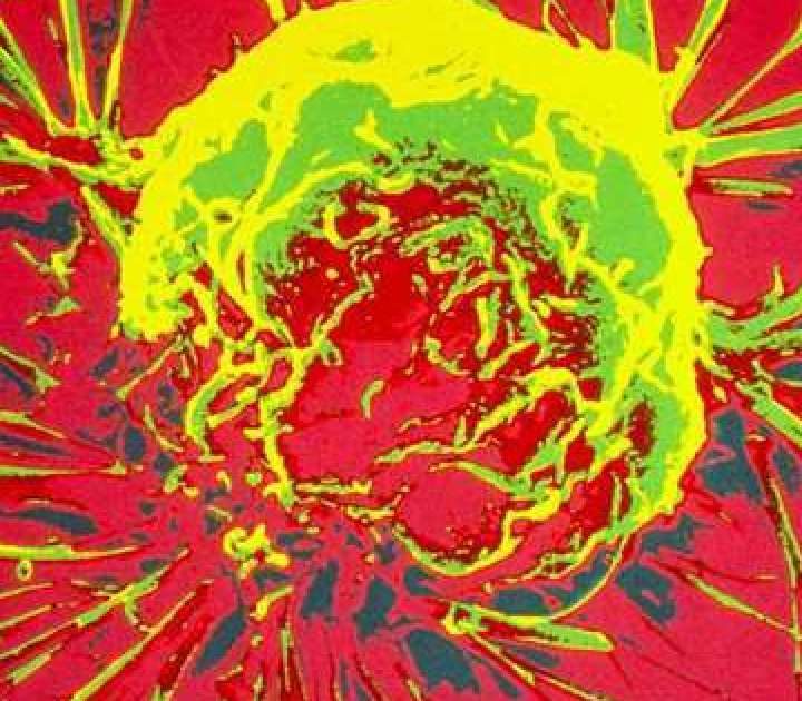 Op-Ed: Using AI to diagnose cancer could mean unneeded treatments – Los Angeles Times