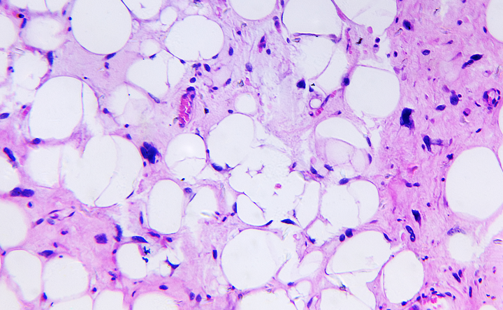 Protein AKAP8 suppresses breast cancer metastasis – Baylor College of Medicine News