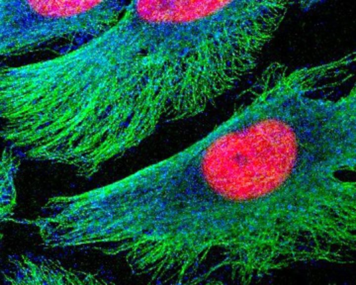 Study: Antigen-based metric may better predict immunotherapy responses – STAT