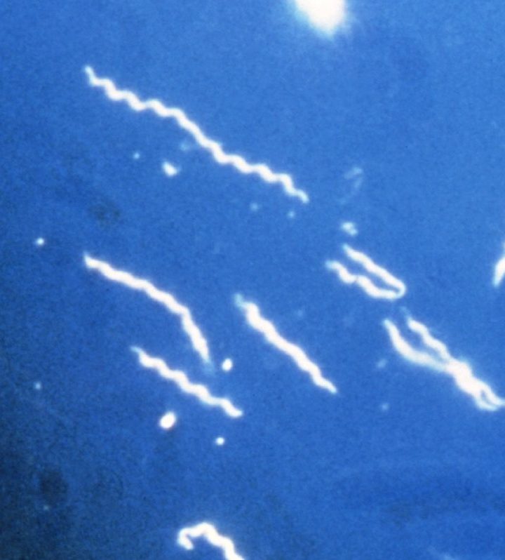 Why the controversy over chronic Lyme disease is important to everyone – The CT Mirror