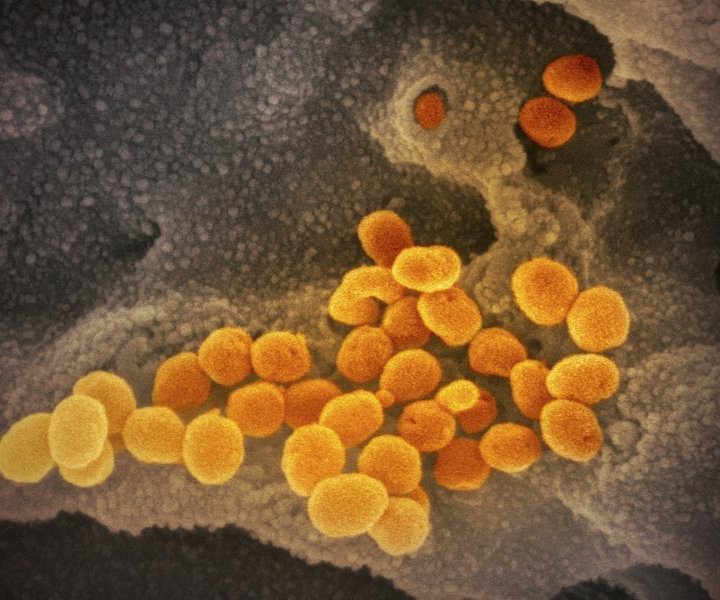 COVID-19 not man-made, comparative genomic study finds – ModernHealthcare.com