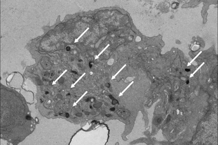 Immunotherapy using ‘young cells’ offers promising option against cancer – EurekAlert