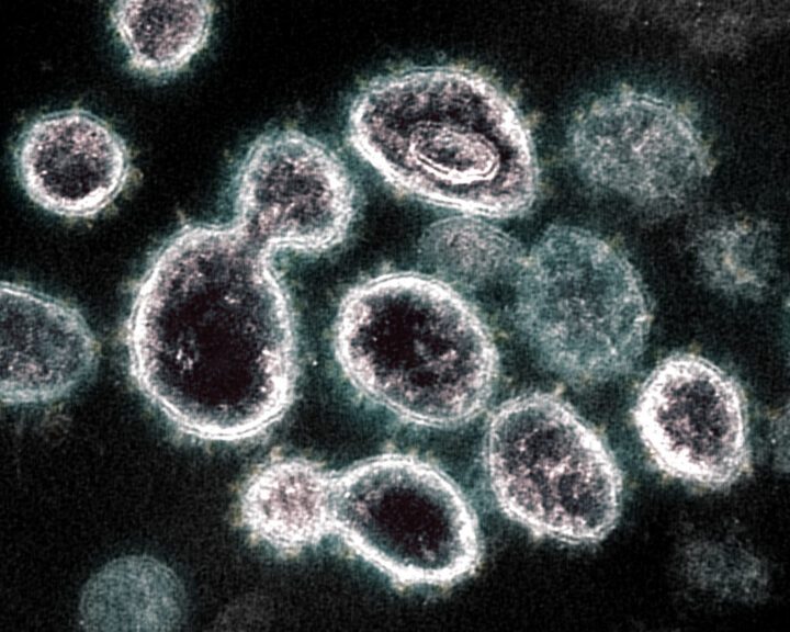 People ‘shed’ coronavirus early, but most likely not infectious after recovery – STAT