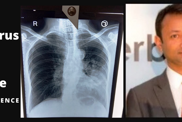 Coronavirus can be cured says natural health consultant Subodh Gupta – Living Gossip