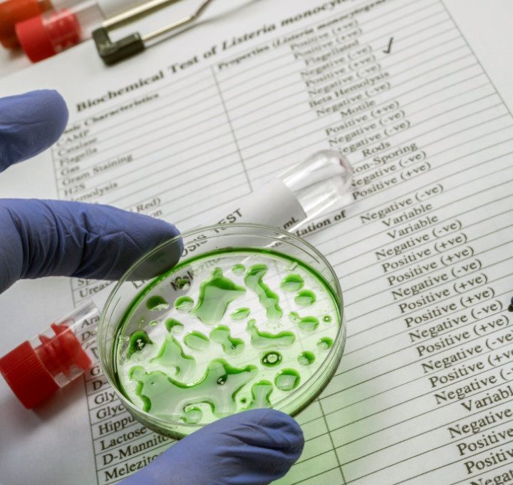 Wageningen calls for Listeria project partners – Food Safety News